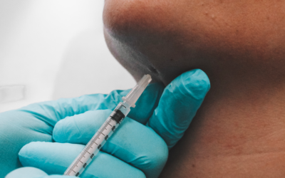 Deoxycholic Acid Injections Calgary, Burnaby & Edmonton