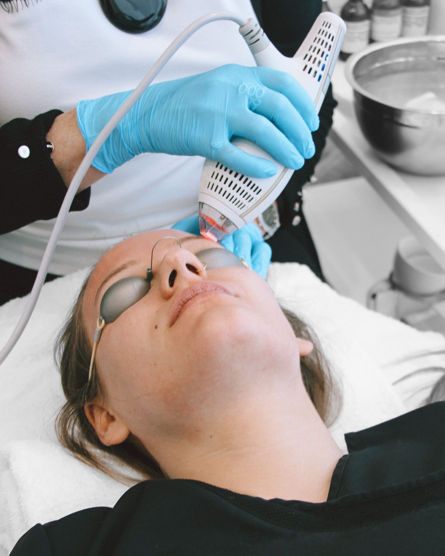 Women getting Clear and Brilliant Face Treatment Calgary, Edmonton & Burnaby