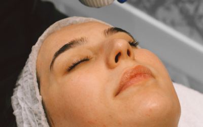Jessner Peel Calgary, Burnaby & Edmonton