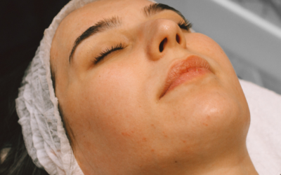 Jessner Peel Calgary, Burnaby & Edmonton