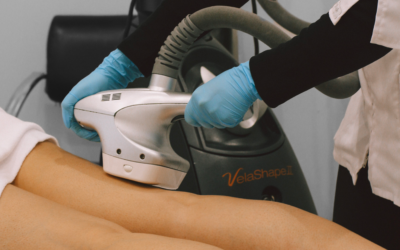 VelaShape® on back of thigh