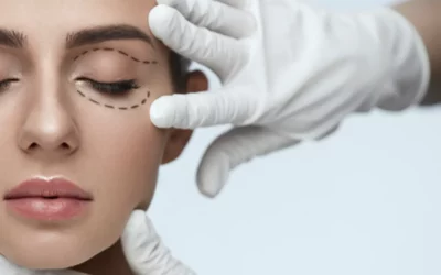 Blepharoplasty - Plastic Surgery Vancouver, Rejuvenation Coal Harbour, Dr. Diana Forbes