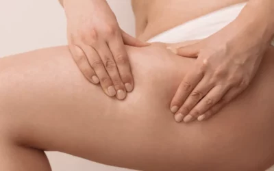 Liposuction - Plastic Surgery Vancouver, Rejuvenation Coal Harbour, Dr. Diana Forbes