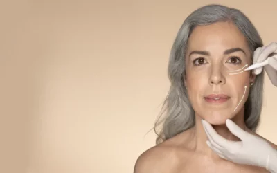 Mini Facelift - Plastic Surgery Vancouver, Rejuvenation Coal Harbour, Dr. Diana Forbes